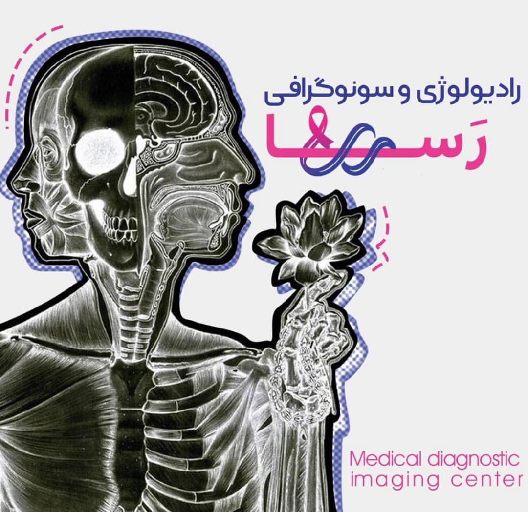 سونوگرافی رسا